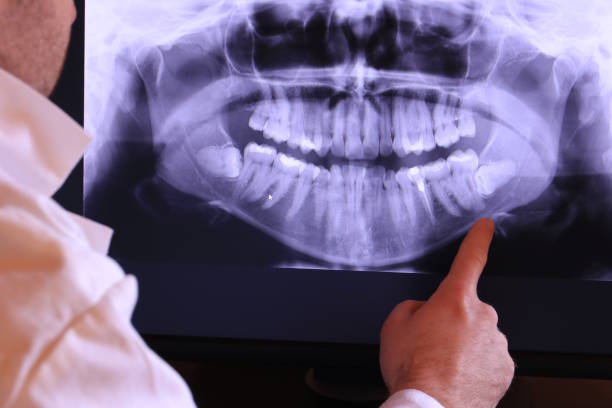 Best Emergency Dental Care for Broken or Chipped Teeth in Golf Manor, OH