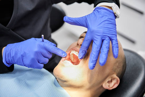 Best Emergency Tooth Extraction in Golf Manor, OH